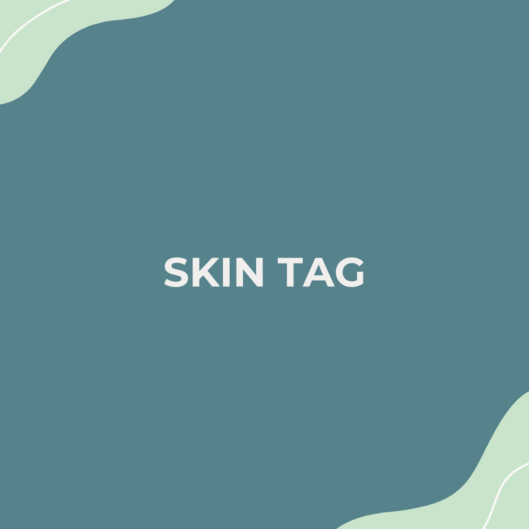 Skin Tag