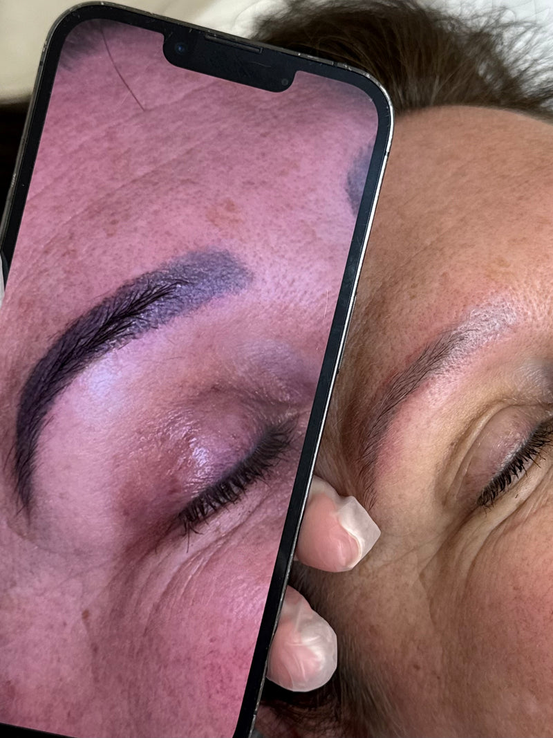 A close-up before-and-after style comparison showing a person's eyebrow and eye area, with a smartphone held in front of the face to display the treated result of just 2 laser tattoo removal sessions on eyebrows