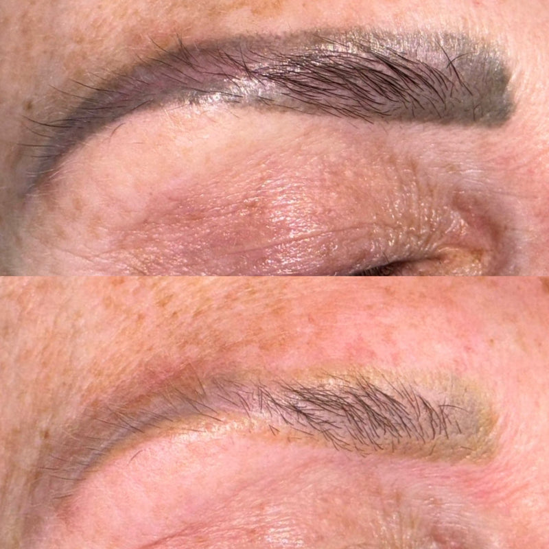 Close-up before-and-after comparison of an eyebrow, showing a fuller, darker eyebrow in the top panel and a sparser, lighter eyebrow in the bottom panel.